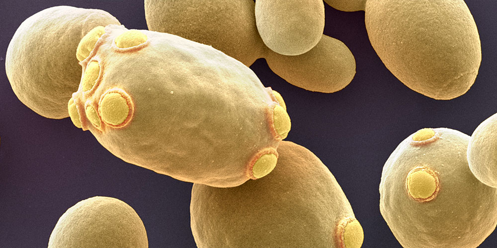 Vergr?sserte Ansicht: Hefezellen verschieben bei der Teilung unerwünschtes Genmaterial in die Mutterzelle, damit die unbelasteten Tochterzellen eine neue Population aufbauen können. (Bild: Univ. Basel /SNI/Nano Imaging Lab)
