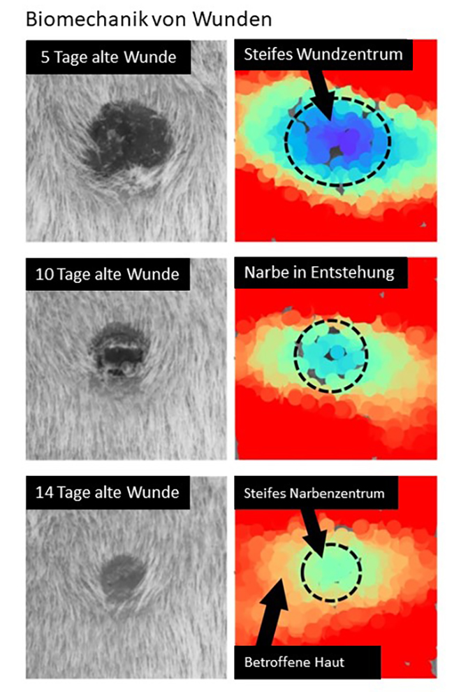 Vergr?sserte Ansicht: Wundmorphologie (linke Spalte) und Deformierbarkeit der Narbe in vivo. (nach Wietecha et al., Nat. Comm., 2020)