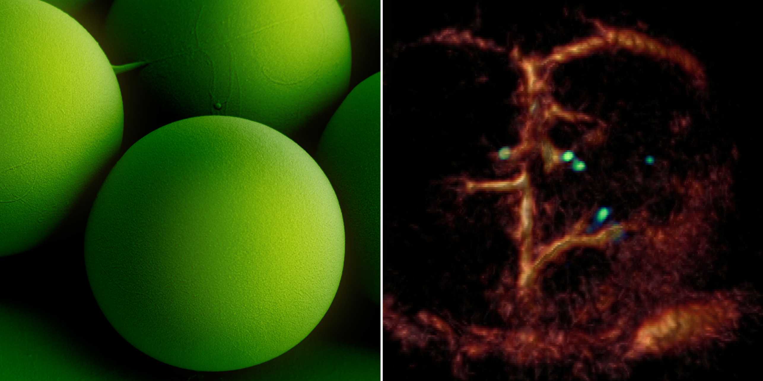 Linkes Bild: Kugelförmige, grüne Mikroroboter. Rechtes Bild: Mehrere Mikroroboter in einem Blutgefäss.