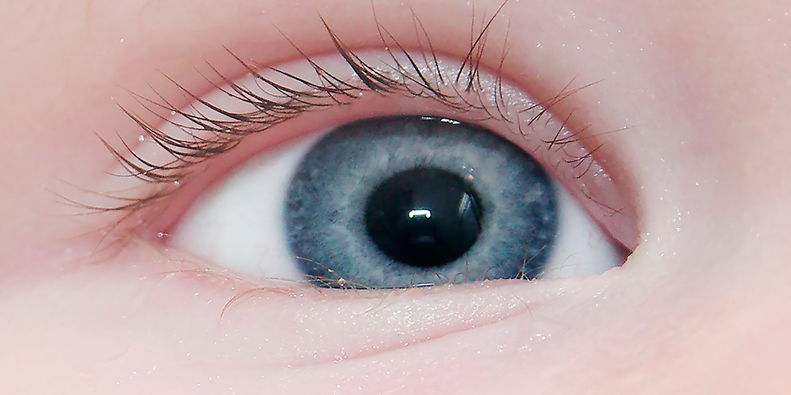 blaues Auge