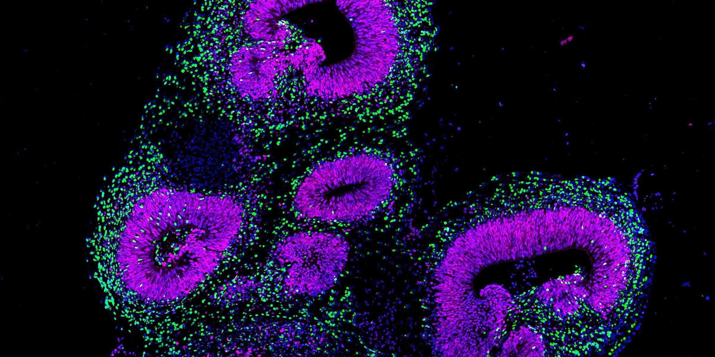 Dieses Bild zeigt ein Gehirn-Organoid aus menschlichen Stammzellen.