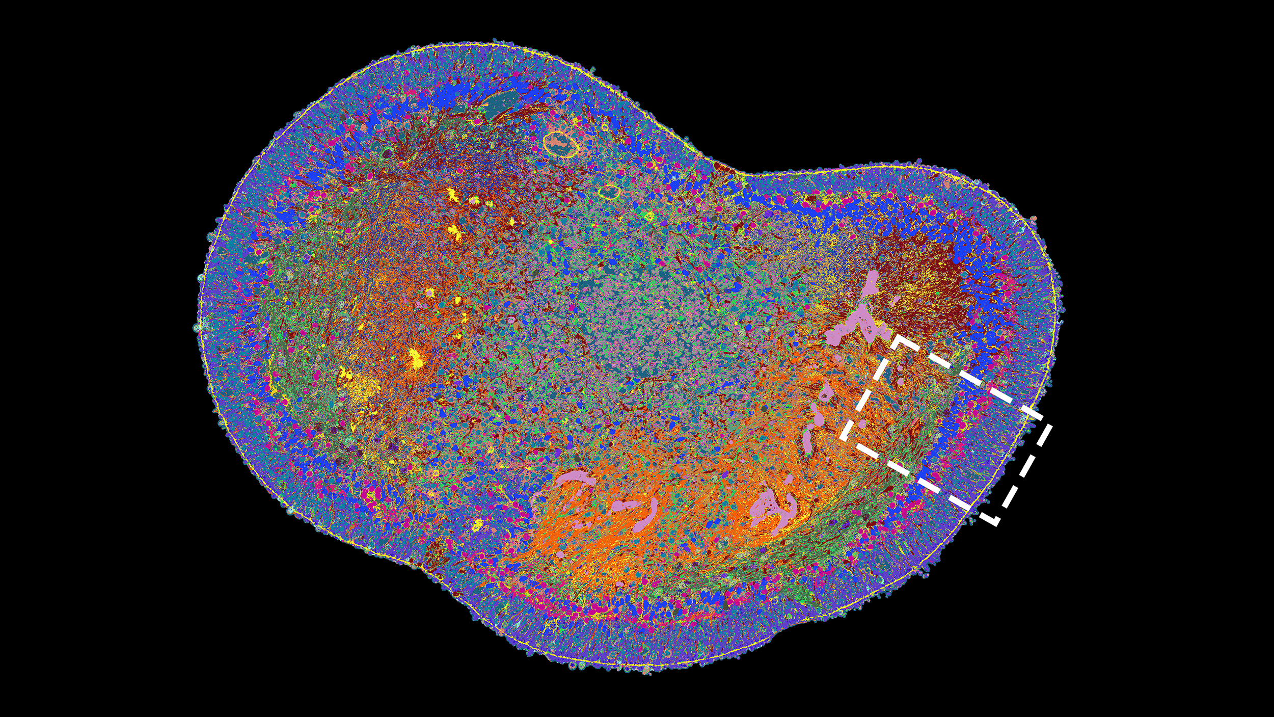 Vergr?sserte Ansicht: Querschnitt eines ganzen Netzhaut-Organoids. Unterschiedliche Proteine sind mit unterschiedlichen Farben sichtbar gemacht.