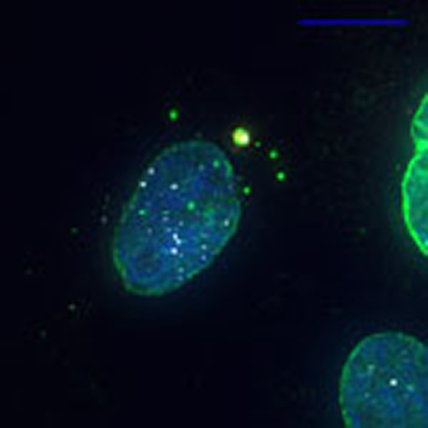 Mikoskopaufnahme, blauer Zellkern vor schwarzem Hintergrund. In der nähe des Zellkerns ist in gelbgrün das Exklusom erkennbar.